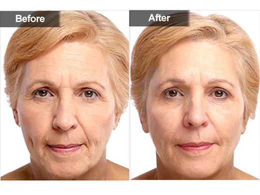 side effects of cosmetics pdf