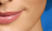 Restylane®