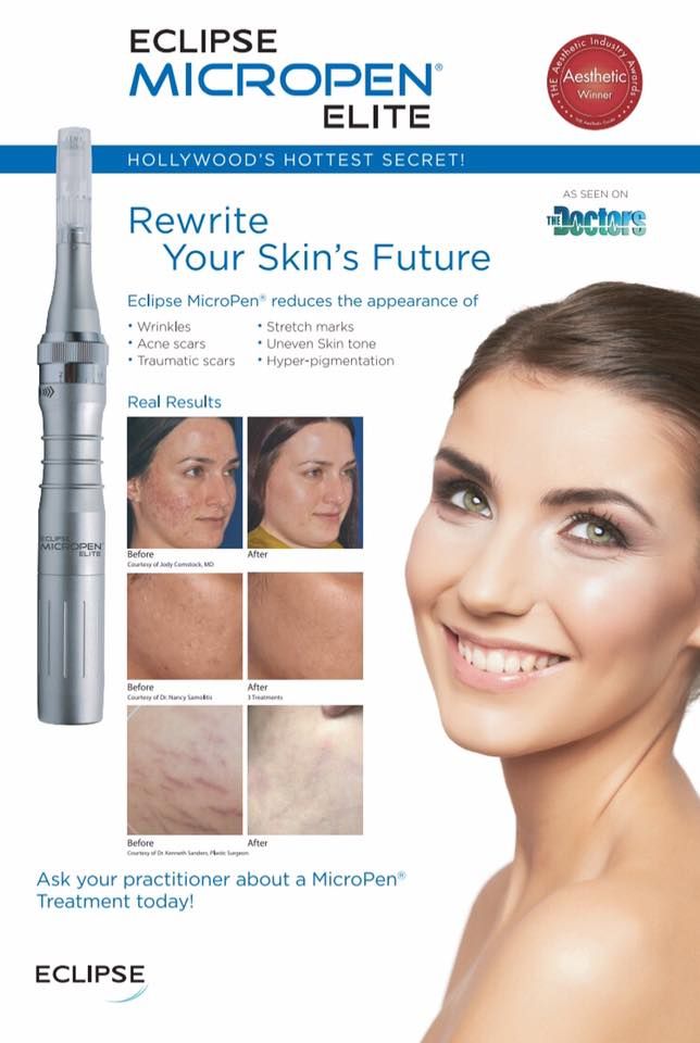 Microneedling & Skin Resurfacing - Venus Viva