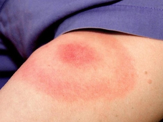 Rashes clinical photo