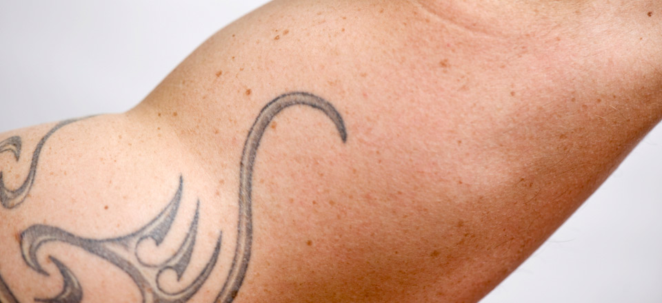 Dermatology & Laser Skin Treatments | Mclean & Woodbridge ...
