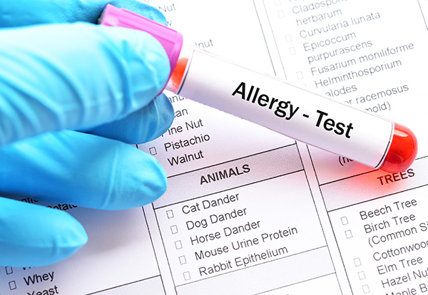 Allergy Testing